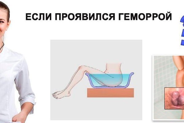 Кракен это современный маркетплейс